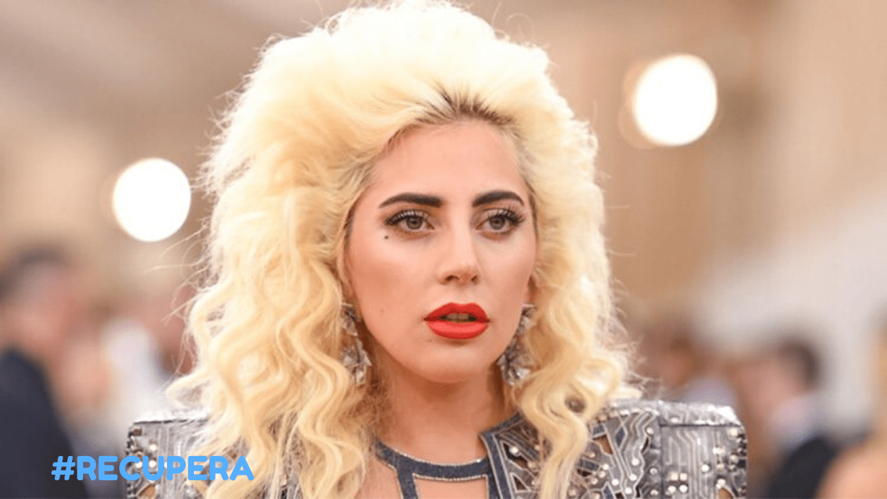 Laidy Gaga Peluca protesis capilar